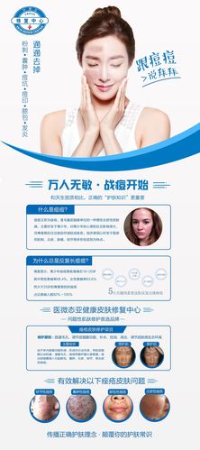 美腻同行，为您的美丽保驾护航(湘雅激光您的毛孔祛痘) 美腻同行，为您的美丽保驾护航(湘雅激光您的毛孔祛痘) 技术资讯
